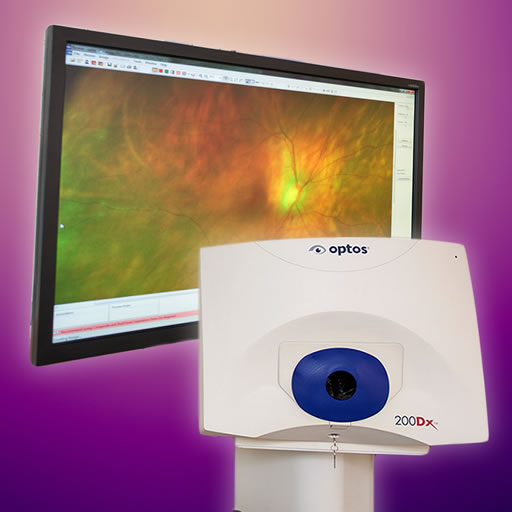 digital retinal imaging